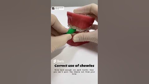 Totara Orthodontists: How to Use Chewies for Invisalign Fit