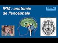 Irm  anatomie de lencphale