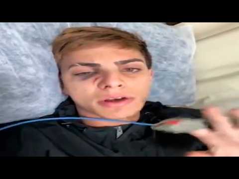 The BIZARRE moment Dudu Tips got BEAT UP by his ex-friend lol