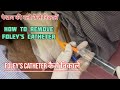 पेशाब की नली कैसे निकालें/How to Remove Foley’sCatheter/Foley’sCatheter कैसे निकालें/ #youtubevideo