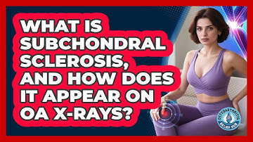What Is Subchondral Sclerosis, And How Does It Appear On OA X-rays? - Osteoarthritis Relief Hub