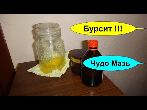 Бурсит лечение в домашних условиях чудо мазь. Воспаление суставов. Эффективное лечение бурсита