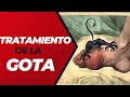 Tratamiento de la Gota. Perlas