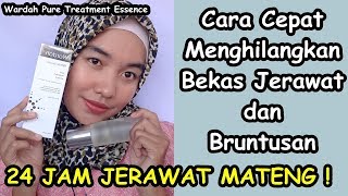 Review Rangkaian Wardah Acnederm + Update Pemakaian 1 Minggu