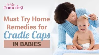 Simple and Effective Home Remedies for Cradle Caps in Babies by FirstCry Parenting 577 views 12 days ago 5 minutes, 28 seconds