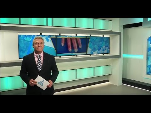 Video: De Ziekte Van Raynaud (syndroom) - Oorzaken, Symptomen En Behandeling