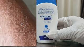moisturex soft lotion | white soft paraffin and light liquid paraffin lotion | moisturex lotion uses screenshot 3