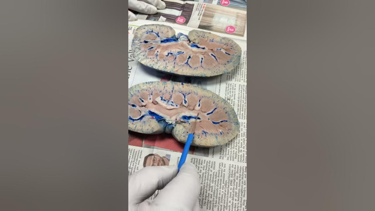 A&P II Sheep Kidney dissection YouTube