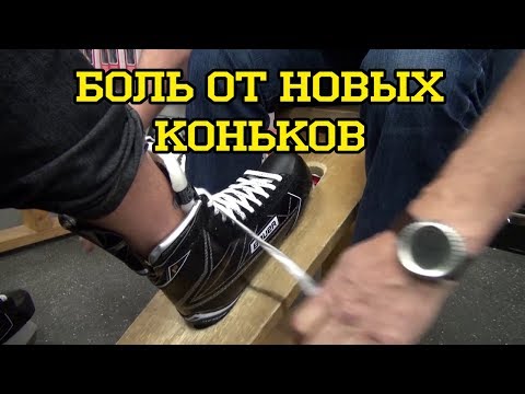 Боль от новых коньков: Термо формовка коньков . New Skate Prep: Why you Should Bake New Skates