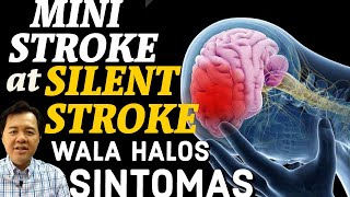 MiniStroke at Silent Stroke: Wala Halos Sintomas  Payo ni Doc Willie Ong