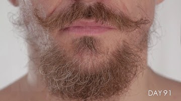 Facial Hair growing for 100 Days in Time-Lapse
