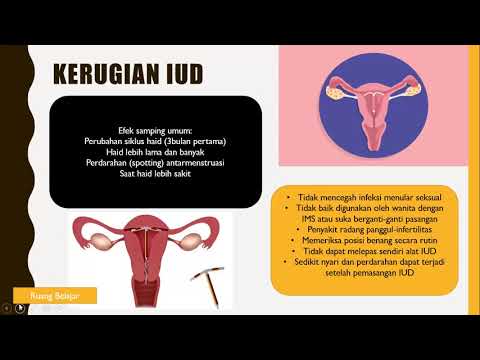 Penyuluhan IUD-AKDR (Alat Kontrasepsi Dalam Rahim)