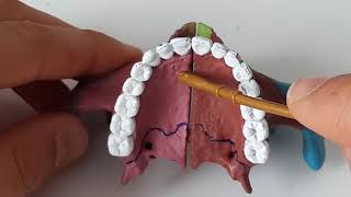 Os Maxilla Os Palatinum