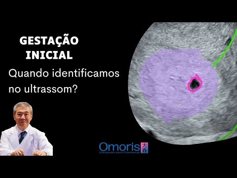 Vídeo: Quan és més gruixut l'endometri?