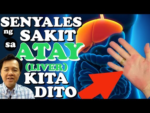 Senyales ng Sakit sa Atay (Liver) - Payo ni Doc Willie Ong (Internist & Cardiologist) #452c