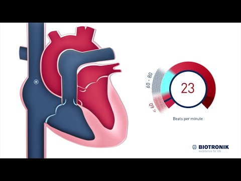 Video: Zpomaluje apresolin srdeční frekvenci?