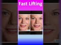 Fast Lifting: Crema Antirughe con Acido Ialuronico e Burro di Karitè - Azione Immediata. #shorts