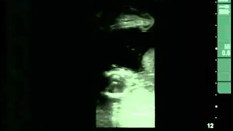 Cow #4539 Day 75 of Gestation