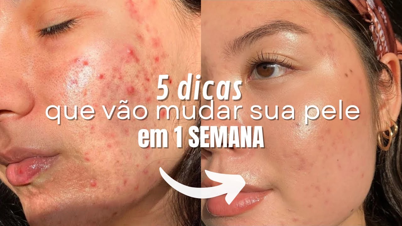 5 dicas que vão TRANSFORMAR a sua pele em 1 SEMANA(ninguém te conta isso)