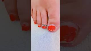Before & After Pedicure Transformation #feet #toes #pedicure #frenchtip #beforeandafter