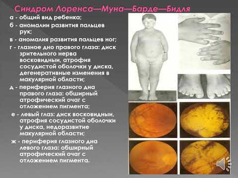 Нарушение менструального цикла. Аменорей. Часть - 5.