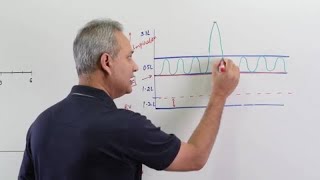 Pulmonary Function Tests (PFTs)