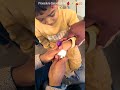 IV Cannulation #usa #youtubeshorts #reels #trendingshorts #trending #viral #viralshorts #doctor