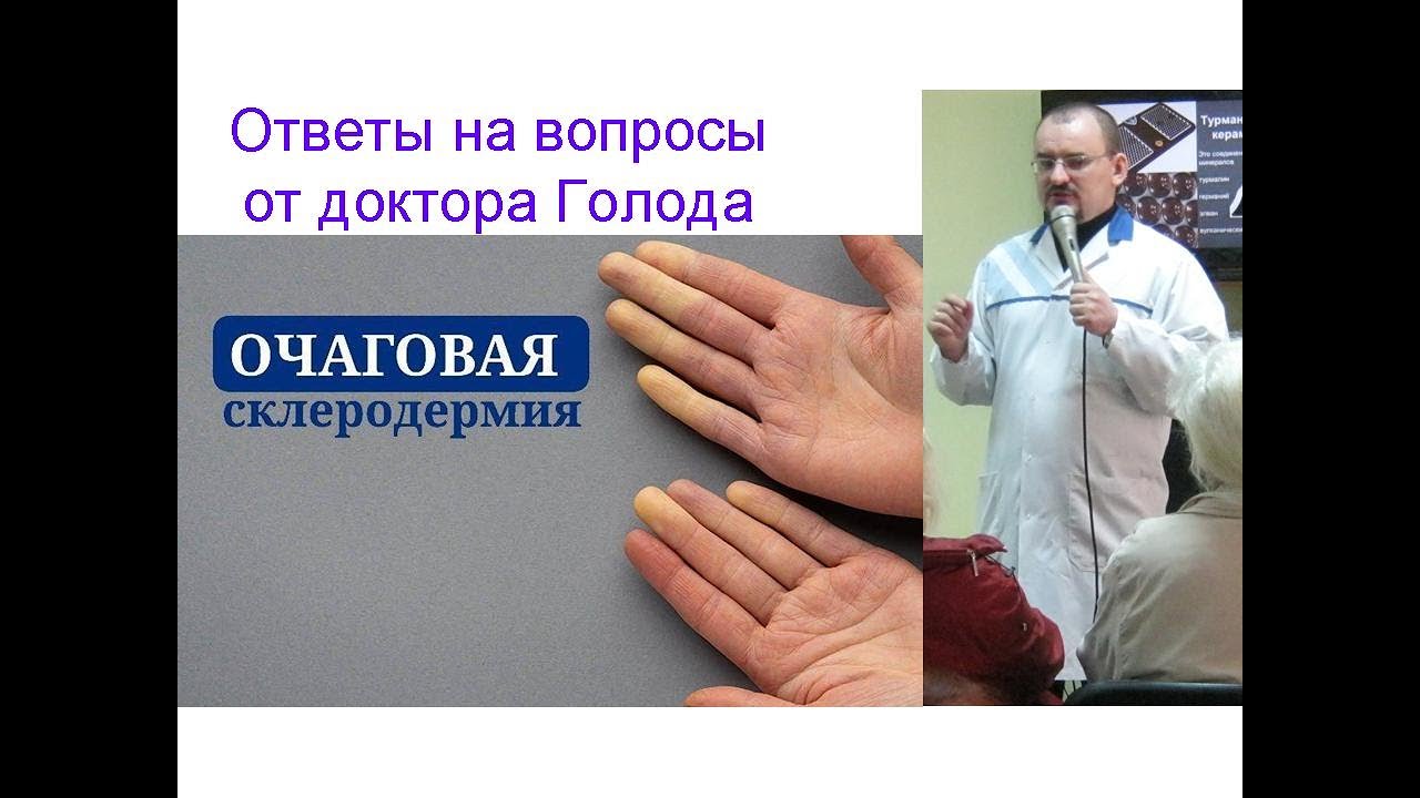 Очаговая склеродермия - ответ от доктора Голода - YouTube