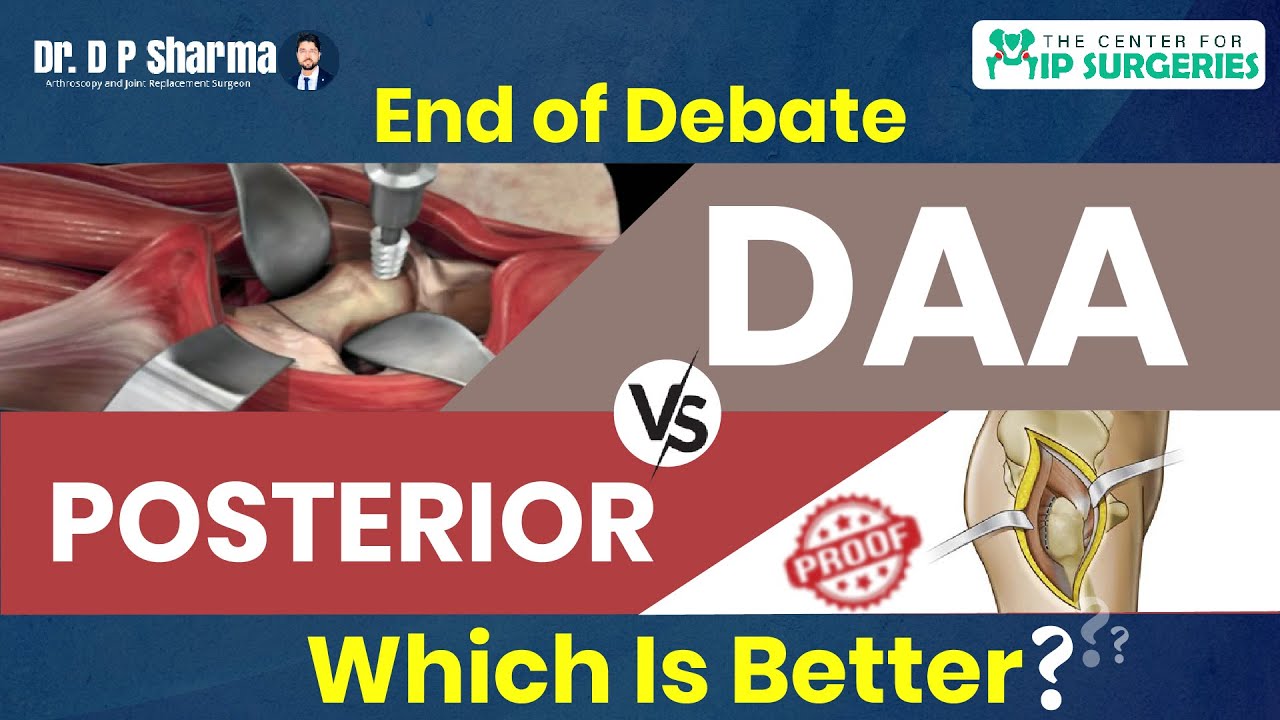 Which THR Technique Is Better? DAA VS POSTERIOR - Hip Replacement ...