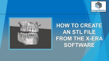 How to Export STL File from ImageWorks OneSystem Software