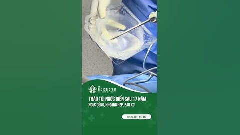 Tháo túi ngực nước biển sau hơn 17 năm #thaotuinguc