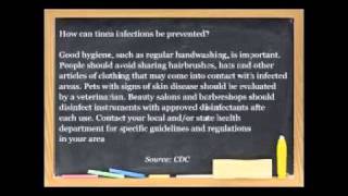 Wrestlers Risk for Ring Worm Infections