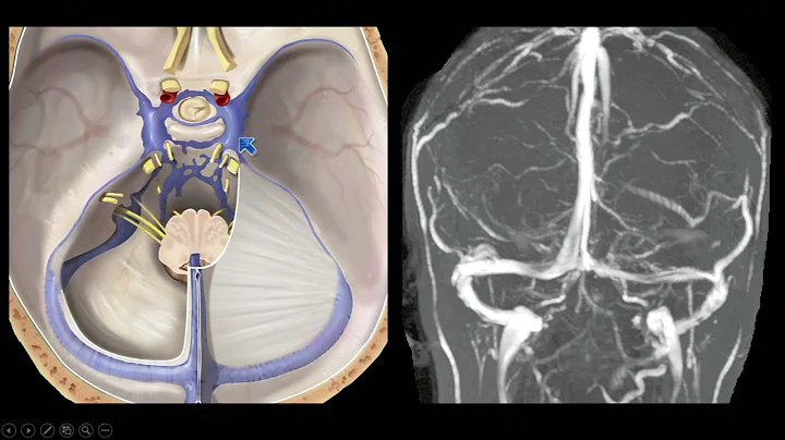 Posterior Skull Base by Richard H. Wiggins, III, M...