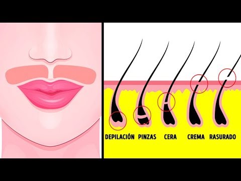 Video: 4 formas de deshacerse del vello facial femenino