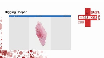 The CPTAC Data Browser: A New Generation of... - Anna Calinawan - Technology Tracks - ISMB/ECCB 2019