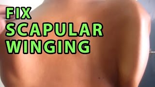 5 Exercises to Fix Winged Scapular | Scapular Stabilising Exercises