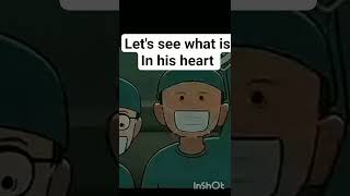 what is in his heart ????? #carexpert  #carexpert