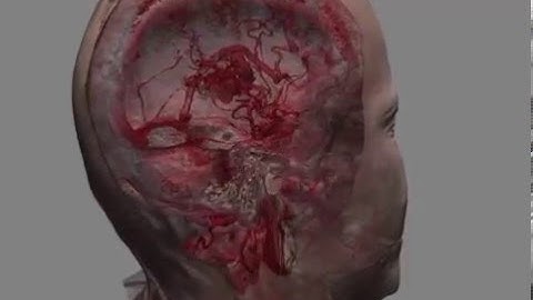 VP Reveal-  3d dicom viewer - Showcase