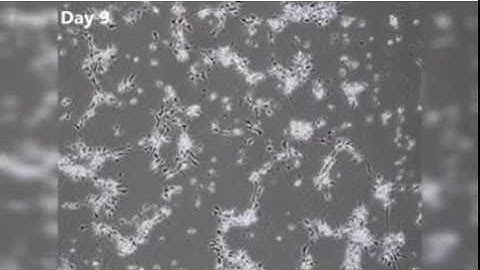 Human stem cells turning into neurons