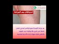 ما هي جراحة الأوعية الدموية والقدم السكري د كريم كمال ما هي جراحة الأوعية الدموية والقدم السكري د كريم كمال