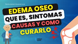 EDEMA ÓSEO: QUE ES Y COMO SE CURA CON MAGNETOTERAPIA ✅