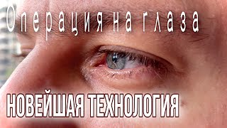 Операция на глаза в лучшей клинике мира 👁 Новейшая технология