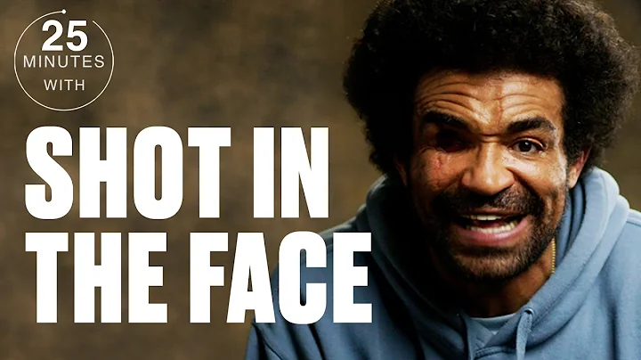 Career Criminal On How He Survived A Shot To The F...