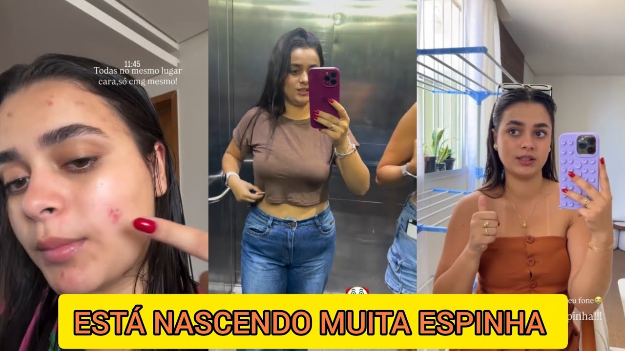 INARA LUIZA MOSTROU SEU ROSTO COM MUITA ESPINHA + PERDEU O FONE NA ACADEMIA 