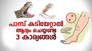 പാമ്പ് കടിയേറ്റാൽ ആദ്യം ചെയ്യണ്ട 3 കാര്യങ്ങൾ | Snake Bite Malayalam