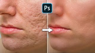 How To Fix Acne Scars or Wrinkles Fast | Photoshop Tutorial screenshot 3