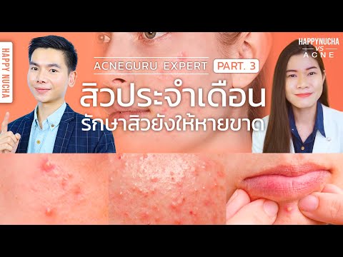 สิวฮอร์โมน สิวที่คาง สิวประจำเดือน สิวที่ผู้หญิงต้องเป็น รักษายังไงให้หายขาด l นุชา HAPPY NUCHA
