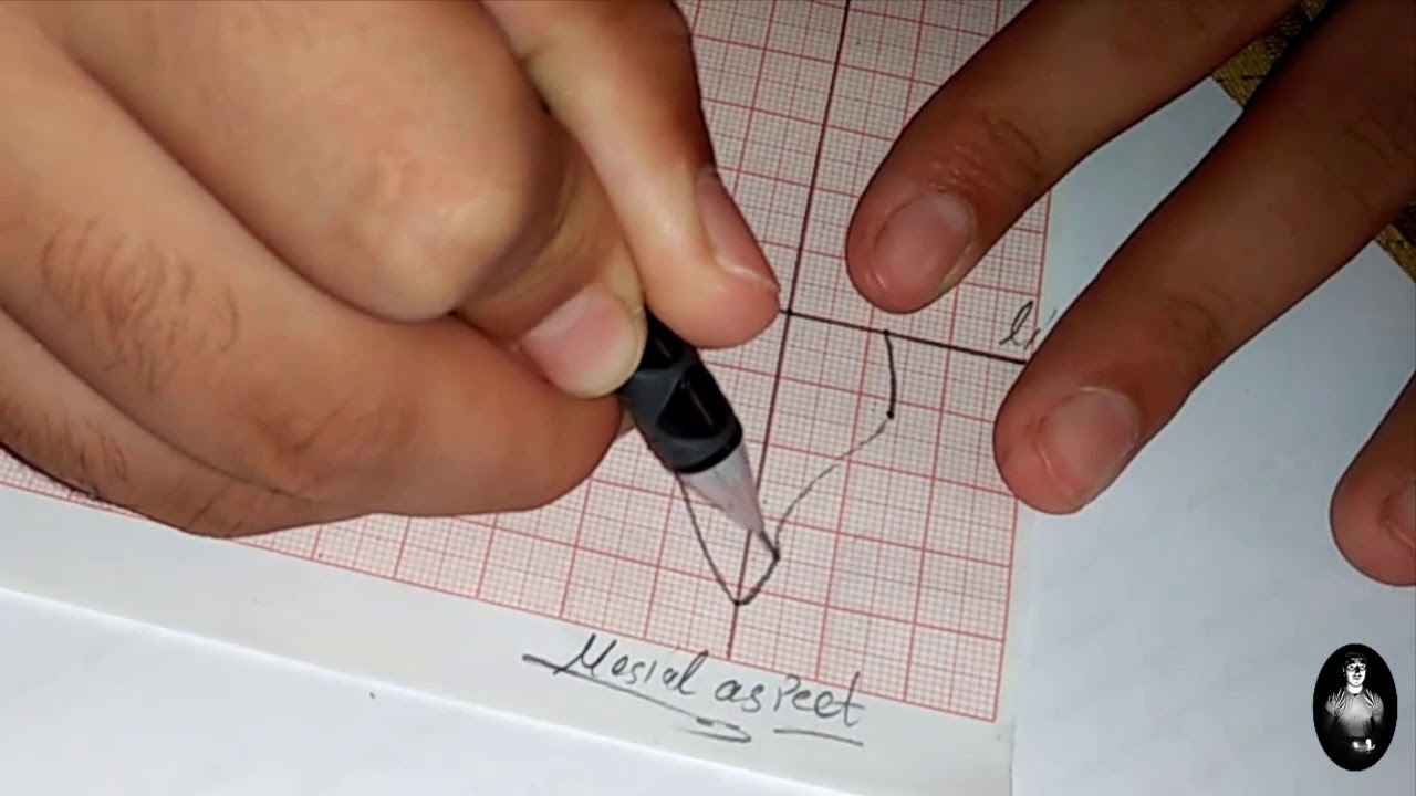 Upper Central Incisor without music