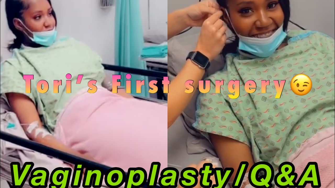 Vaginoplasty Q&A Part 1