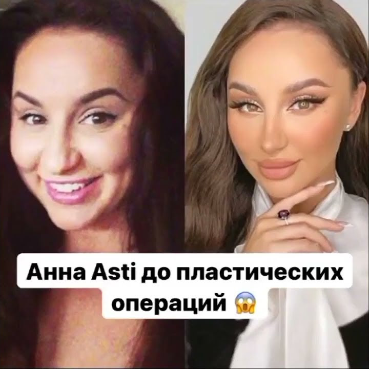 Стала недолободой": Фанаты певицы Asti не поняли её "переделки